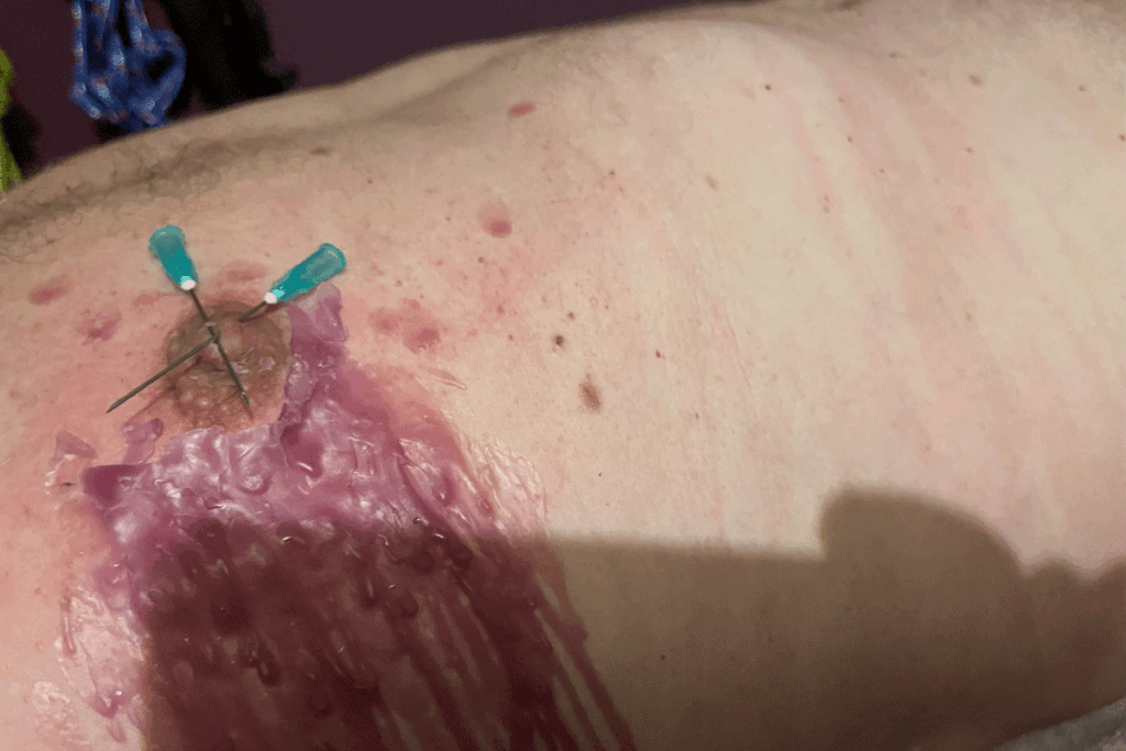 Pijnlijke minuten in de bek van een "DHZ-krokodil"